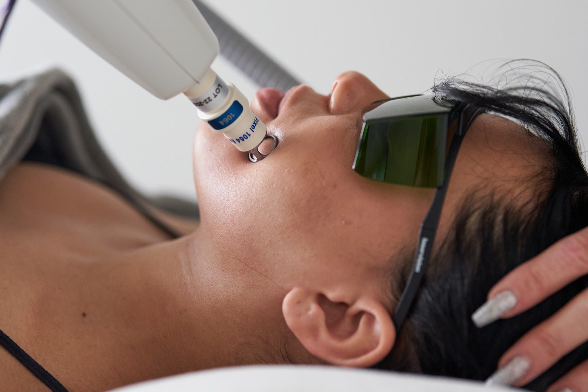 Skin Tightening  Kelowna Laser Spa